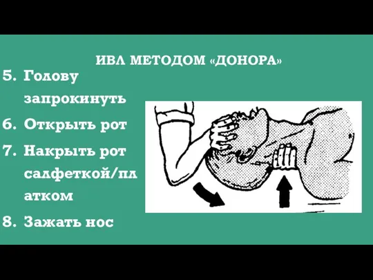 ИВЛ МЕТОДОМ «ДОНОРА» Голову запрокинуть Открыть рот Накрыть рот салфеткой/платком Зажать нос