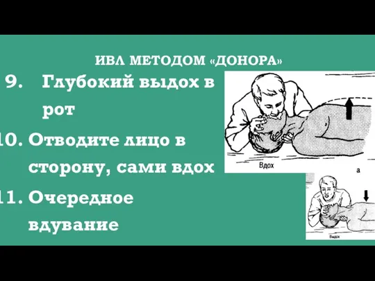 ИВЛ МЕТОДОМ «ДОНОРА» Глубокий выдох в рот Отводите лицо в сторону, сами вдох Очередное вдувание