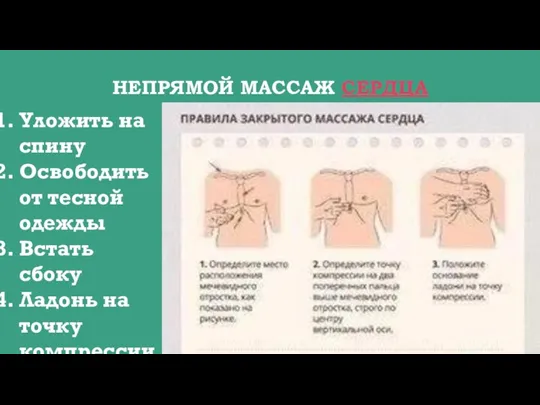 НЕПРЯМОЙ МАССАЖ СЕРДЦА Уложить на спину Освободить от тесной одежды Встать сбоку Ладонь на точку компрессии