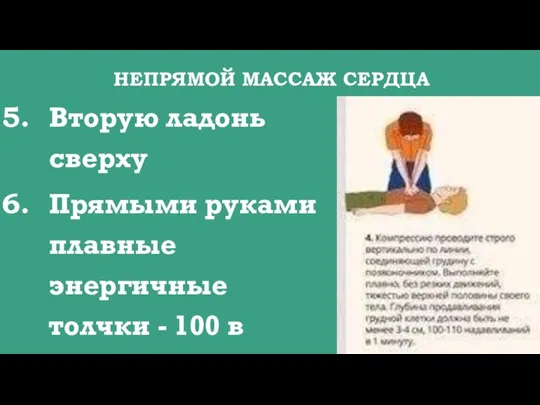 НЕПРЯМОЙ МАССАЖ СЕРДЦА Вторую ладонь сверху Прямыми руками плавные энергичные толчки - 100 в минуту