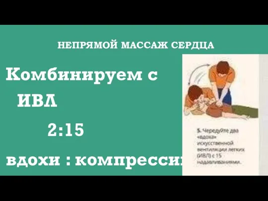 НЕПРЯМОЙ МАССАЖ СЕРДЦА Комбинируем с ИВЛ 2:15 вдохи : компрессии