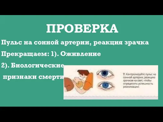 ПРОВЕРКА Пульс на сонной артерии, реакция зрачка Прекращаем: 1). Оживление 2). Биологические признаки смерти