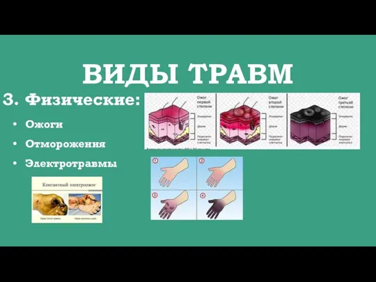 ВИДЫ ТРАВМ Физические: Ожоги Отморожения Электротравмы