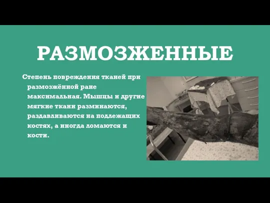 РАЗМОЗЖЕННЫЕ Степень повреждения тканей при размозжённой ране максимальная. Мышцы и другие мягкие