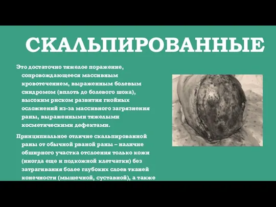 СКАЛЬПИРОВАННЫЕ Это достаточно тяжелое поражение, сопровождающееся массивным кровотечением, выраженным болевым синдромом (вплоть