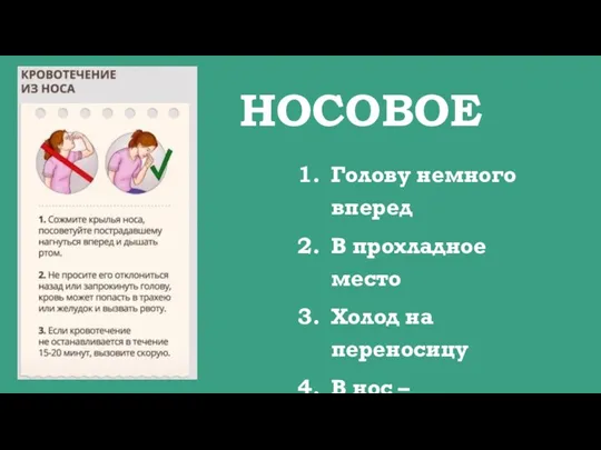 НОСОВОЕ Голову немного вперед В прохладное место Холод на переносицу В нос – стерильный бинтовой тампон