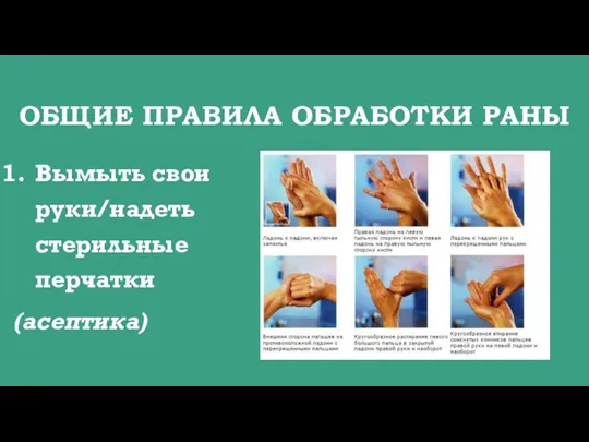 ОБЩИЕ ПРАВИЛА ОБРАБОТКИ РАНЫ Вымыть свои руки/надеть стерильные перчатки (асептика)