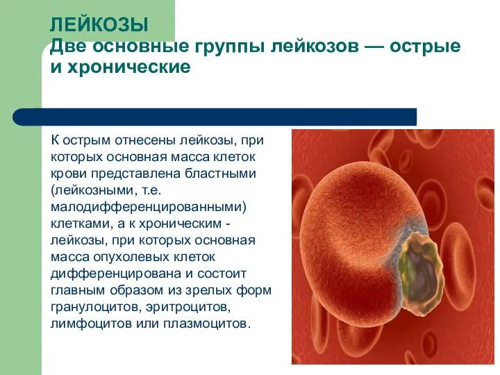 ЛЕЙКОЗЫ Две основные группы лейкозов — острые и хронические К острым отнесены