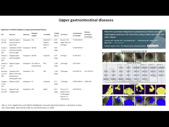 Upper gastrointestinal diseases Zhou J, et al. Application of artificial intelligence in