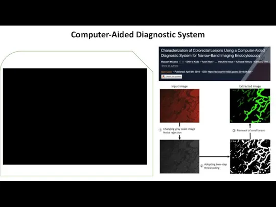 Computer-Aided Diagnostic System