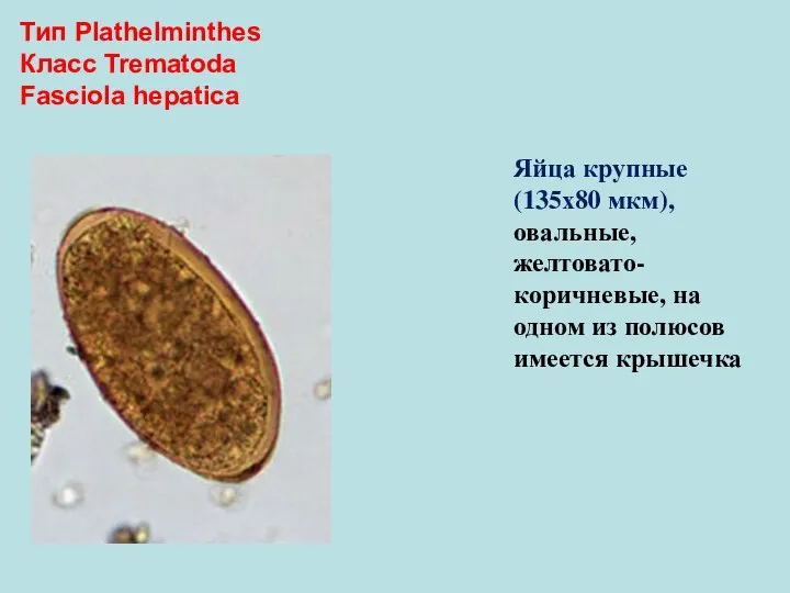 Тип Plathelminthes Класс Trematoda Fasciola hepatica Яйца крупные (135х80 мкм), овальные, желтовато-коричневые,