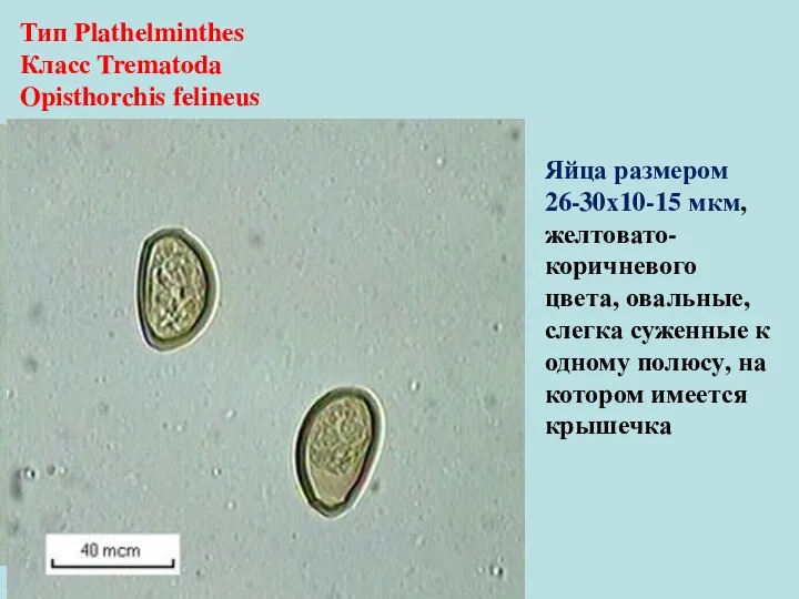 Тип Plathelminthes Класс Trematoda Opisthorchis felineus Яйца размером 26-30х10-15 мкм, желтовато-коричневого цвета,