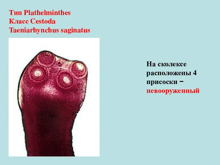 На сколексе расположены 4 присоски − невооруженный Тип Plathelminthes Класс Cestoda Taeniarhynchus saginatus