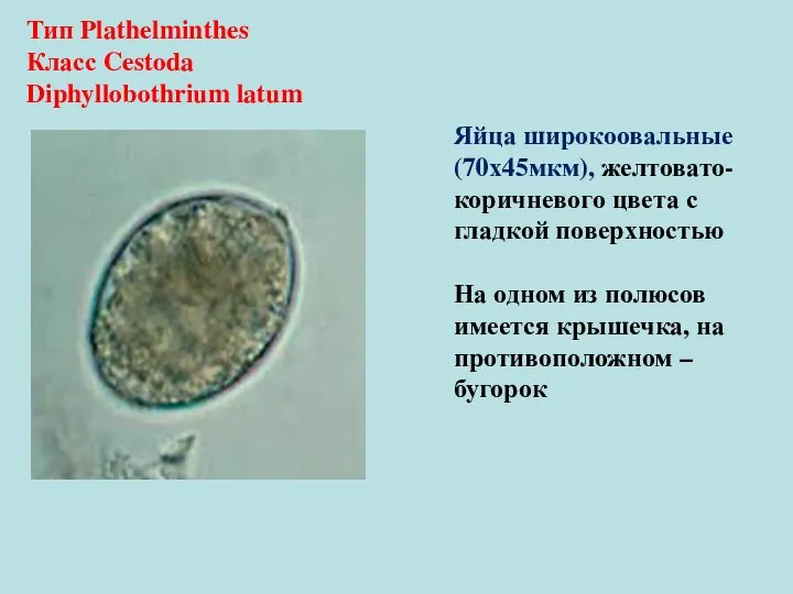 Тип Plathelminthes Класс Cestoda Diphyllobothrium latum Яйца широкоовальные (70х45мкм), желтовато-коричневого цвета с
