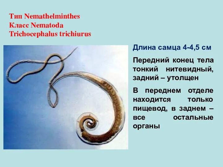 Тип Nemathelminthes Класс Nematoda Trichocephalus trichiurus Длина самца 4-4,5 см Передний конец