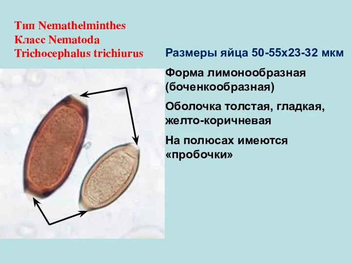 Тип Nemathelminthes Класс Nematoda Trichocephalus trichiurus Размеры яйца 50-55х23-32 мкм Форма лимонообразная