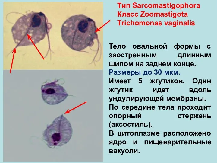 Тип Sarcomastigophora Класс Zoomastigota Trichomonas vaginalis Тело овальной формы с заостренным длинным