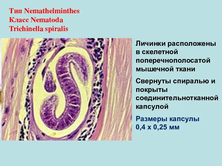 Тип Nemathelminthes Класс Nematoda Trichinella spiralis Личинки расположены в скелетной поперечнополосатой мышечной