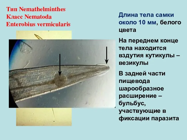 Тип Nemathelminthes Класс Nematoda Enterobius vermicularis Длина тела самки около 10 мм,