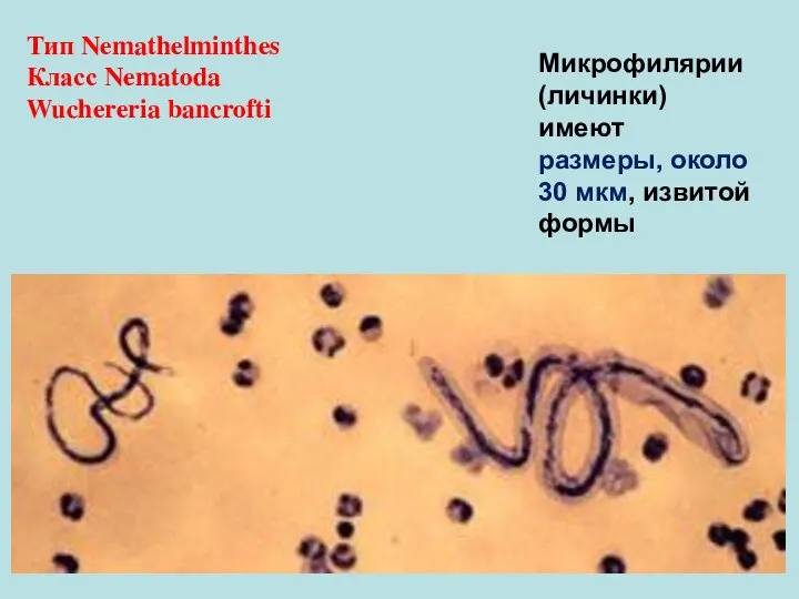 Тип Nemathelminthes Класс Nematoda Wuchereria bancrofti Микрофилярии (личинки) имеют размеры, около 30 мкм, извитой формы