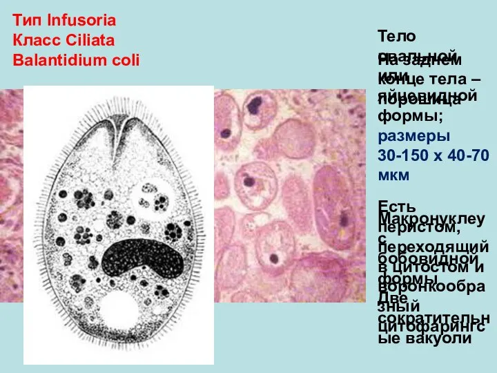 Тип Infusoria Класс Ciliata Balantidium coli Тело овальной или яйцевидной формы; размеры