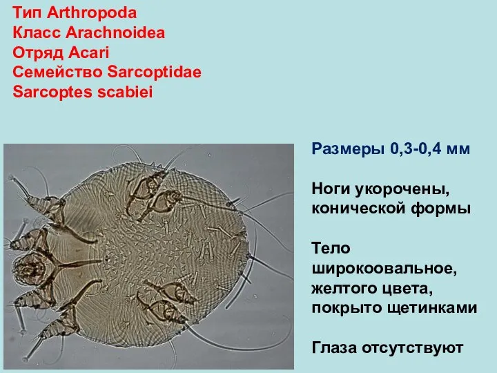 Тип Arthropoda Класс Arachnoidea Отряд Аcari Семейство Sarcoptidae Sarcoptes scabiei Размеры 0,3-0,4