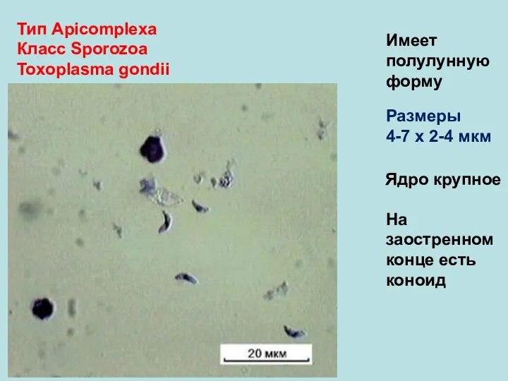 Тип Аpicomplexa Класс Sporozoa Toxoplasma gondii Имеет полулунную форму Размеры 4-7 х
