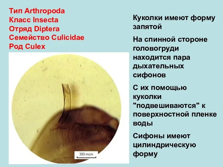 Тип Arthropoda Класс Insecta Отряд Diptera Семейство Culicidae Род Culex Куколки имеют