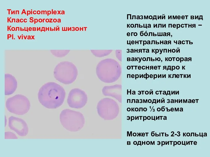 Тип Аpicomplexa Класс Sporozoa Кольцевидный шизонт Pl. vivax Плазмодий имеет вид кольца