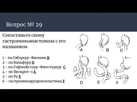 Вопрос № 29 Сопоставьте схему гастроеюноанастомоза с его названием. 1 - по