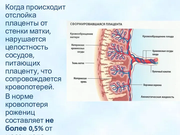 Когда происходит отслойка плаценты от стенки матки, нарушается целостность сосудов, питающих плаценту,