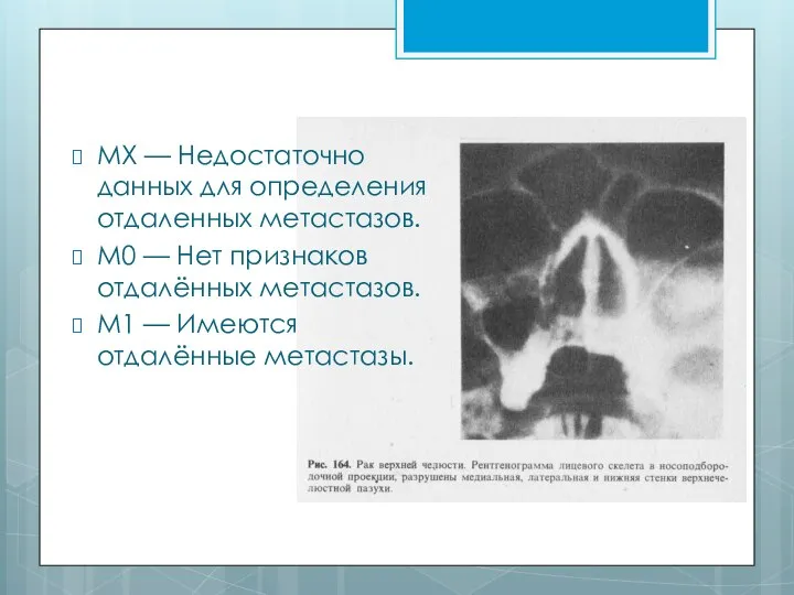 MX — Недостаточно данных для определения отдаленных метастазов. М0 — Нет признаков