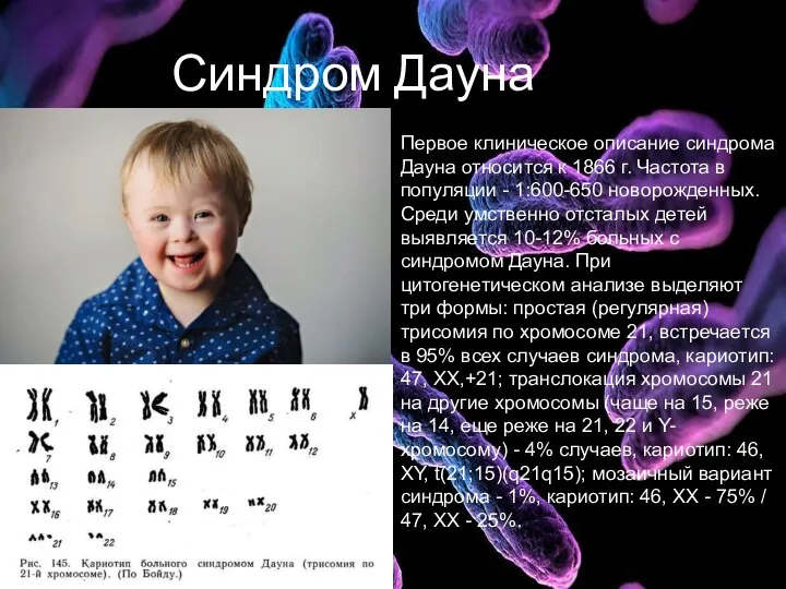 Синдром Дауна Первое клиническое описание синдрома Дауна относится к 1866 г. Частота