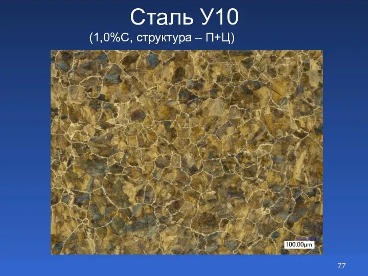 Сталь У10 (1,0%С, структура – П+Ц)