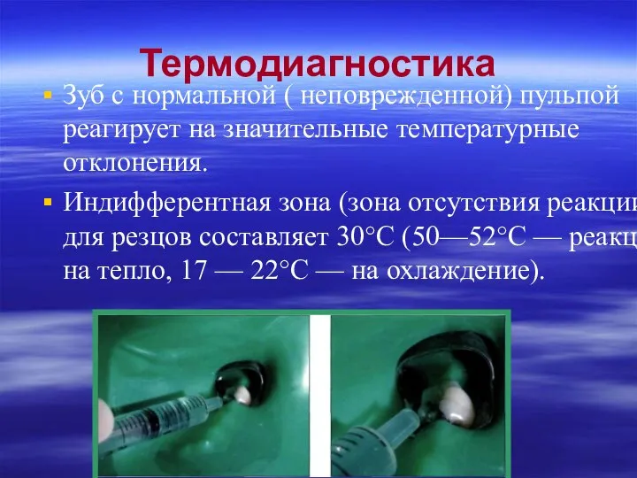 Термодиагностика Зуб с нормальной ( неповрежденной) пульпой реагирует на значительные температурные отклонения.