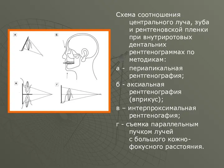 Схема соотношения центрального луча, зуба и рентгеновской пленки при внутриротовых дентальних рентгенограммах