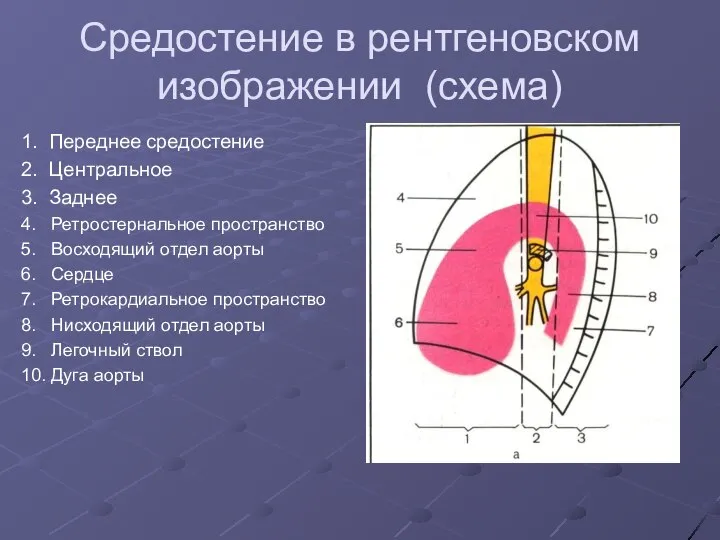 Средостение в рентгеновском изображении (схема) 1. Переднее средостение 2. Центральное 3. Заднее