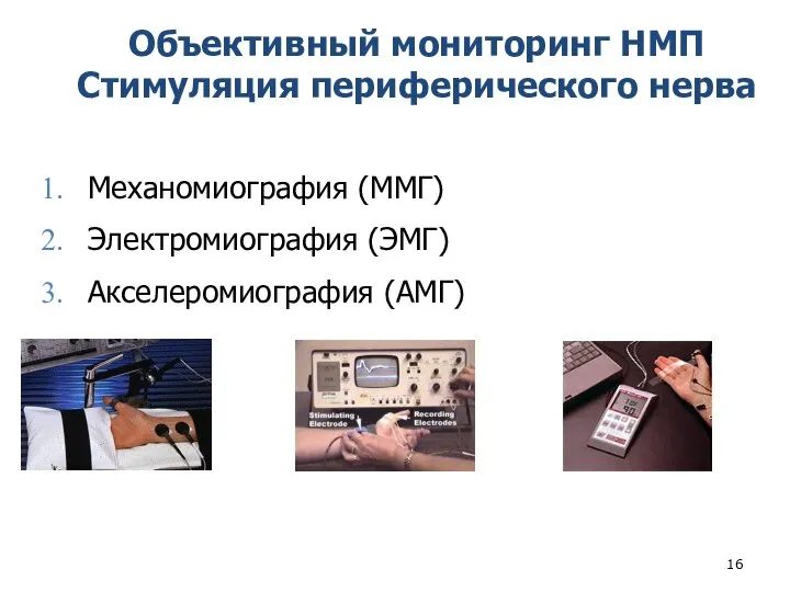 Объективный мониторинг НМП Стимуляция периферического нерва Механомиография (ММГ) Электромиография (ЭМГ) Акселеромиография (АМГ)