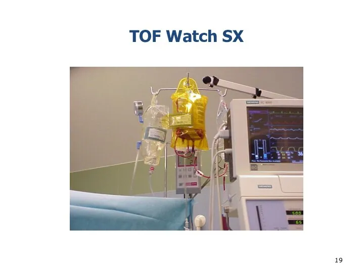 TOF Watch SX