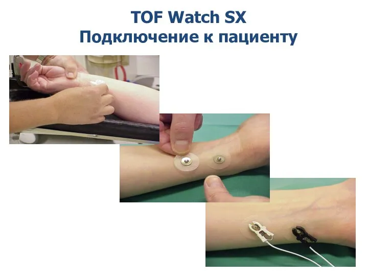 TOF Watch SX Подключение к пациенту