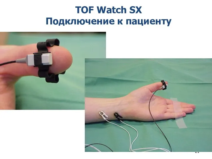 TOF Watch SX Подключение к пациенту