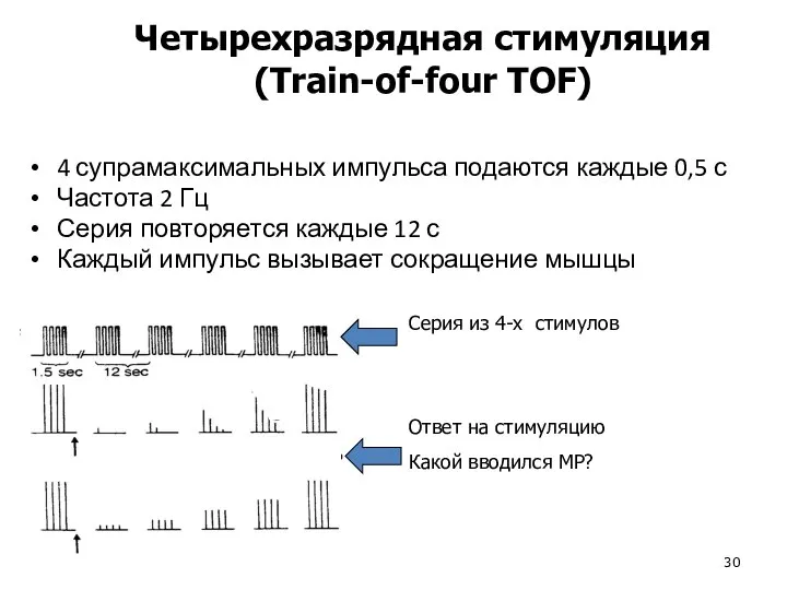 4 супрамаксимальных импульса подаются каждые 0,5 с Частота 2 Гц Серия повторяется