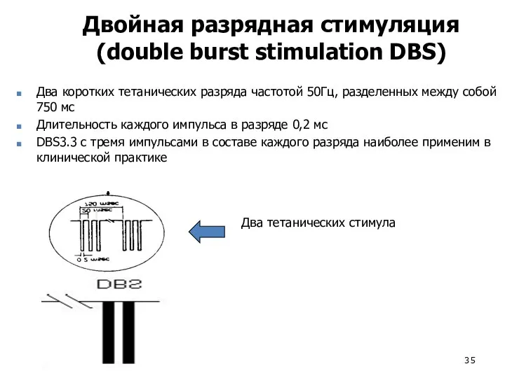 Два тетанических стимула Двойная разрядная стимуляция (double burst stimulation DBS) Два коротких