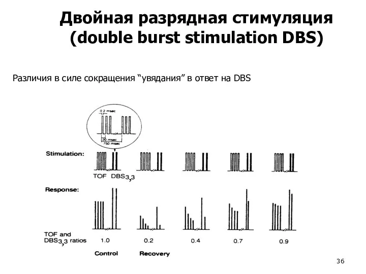 Двойная разрядная стимуляция (double burst stimulation DBS) Различия в силе сокращения “увядания” в ответ на DBS