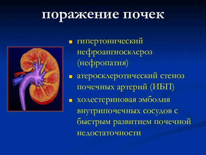 поражение почек гипертонический нефроангиосклероз (нефропатия) атеросклеротический стеноз почечных артерий (ИБП) холестериновая эмболия