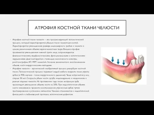 АТРОФИЯ КОСТНОЙ ТКАНИ ЧЕЛЮСТИ Атрофия костной ткани челюсти – это прогрессирующий патологический