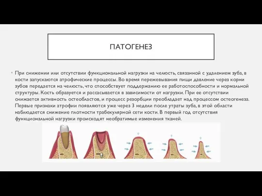 ПАТОГЕНЕЗ При снижении или отсутствии функциональной нагрузки на челюсть, связанной с удалением