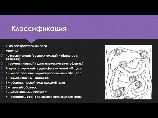 Классификация 2. По распространенности Местный - отграниченный (воспалительный инфильтрат, абсцесс) - неотграниченный