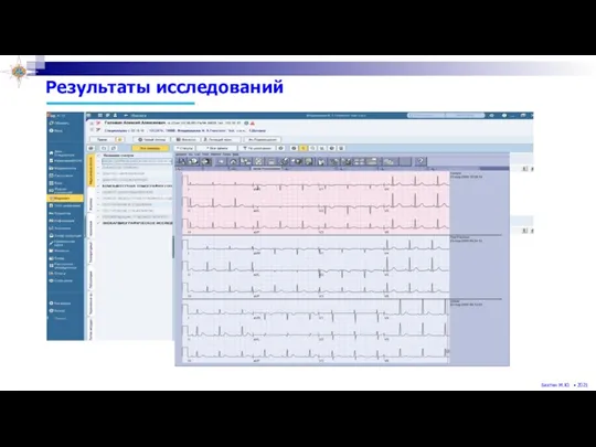 Результаты исследований