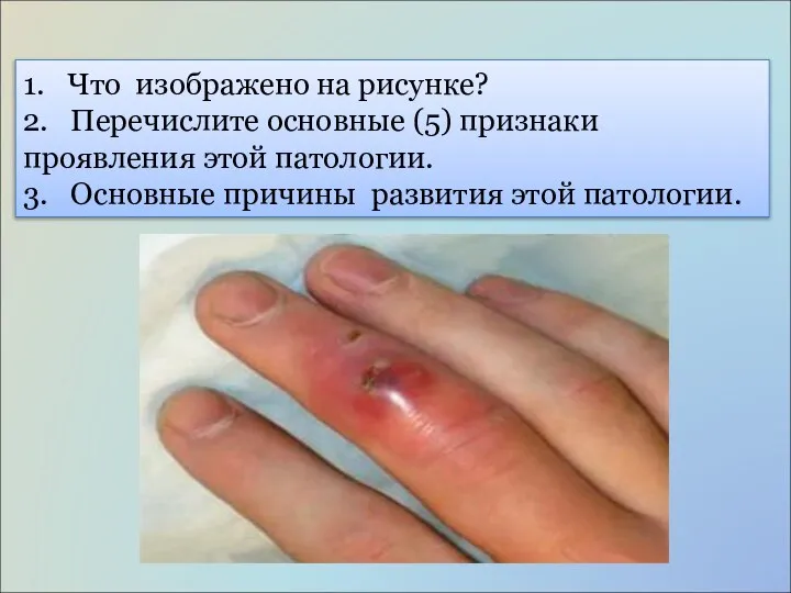 1. Что изображено на рисунке? 2. Перечислите основные (5) признаки проявления этой